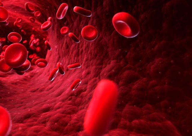 Eisenmangel macht Haarausfall